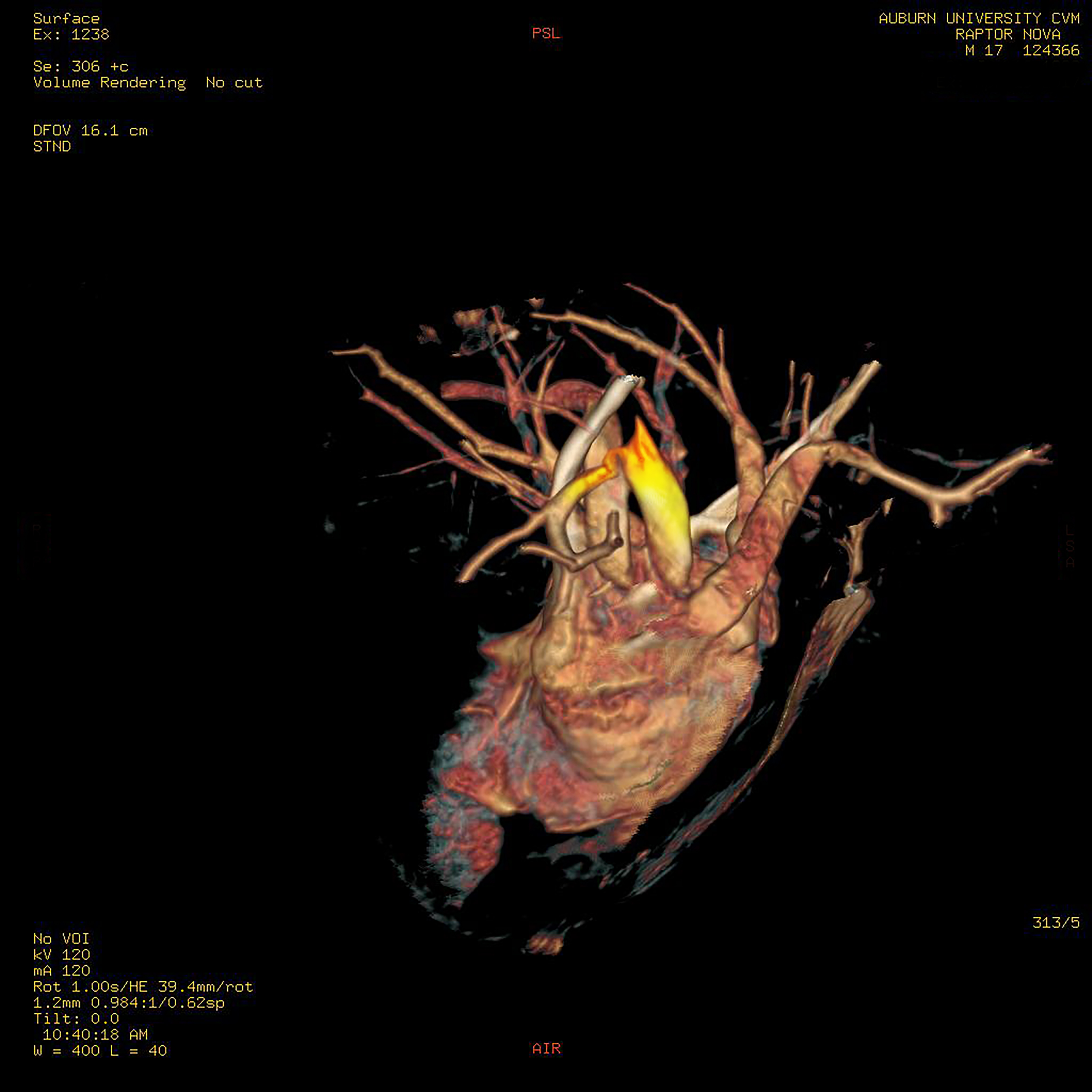 Nova's heart