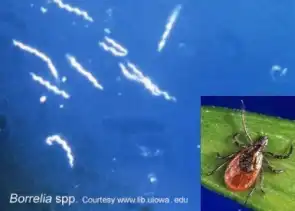 Borrelia burgdorferi bacteria with inset of tick