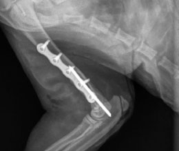 Radiograph of fracture repair